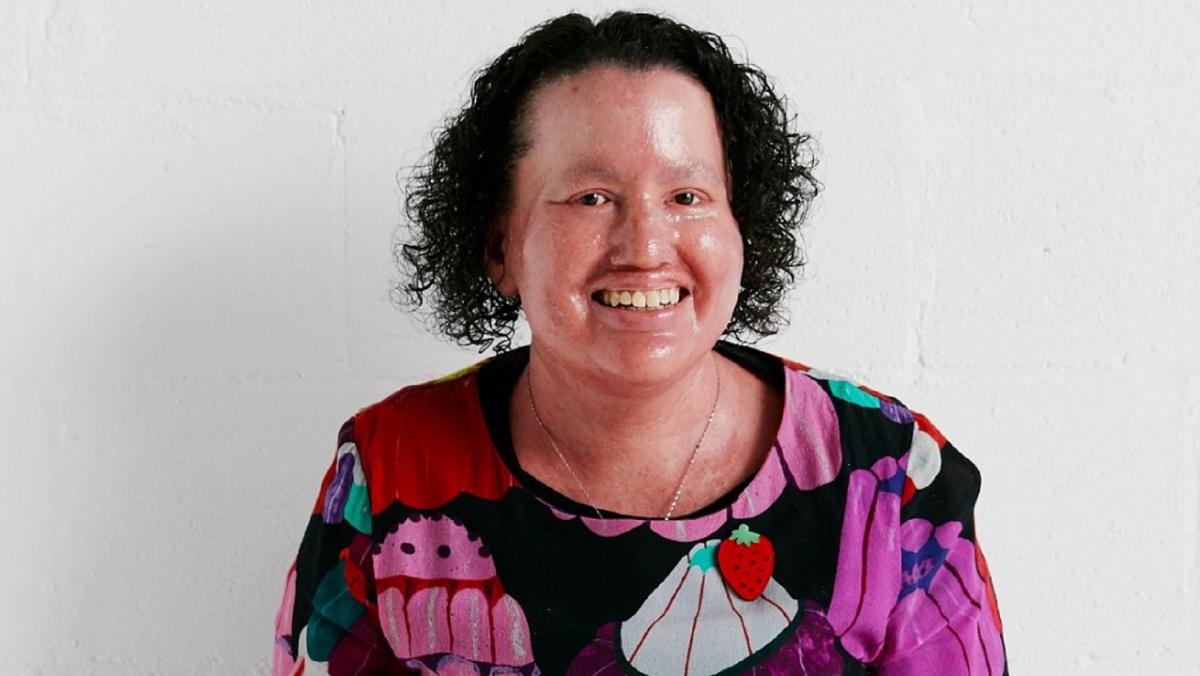 Image of Carly Findlay